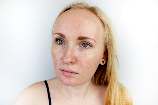 8 Simple Ways to Improve Congested Skin and Clogged Pores