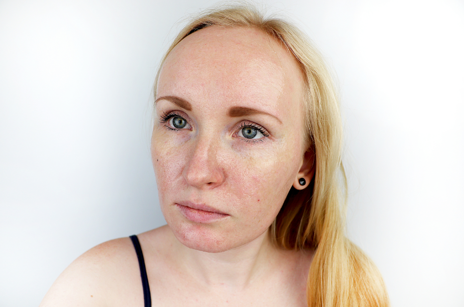 8 Simple Ways to Improve Congested Skin and Clogged Pores