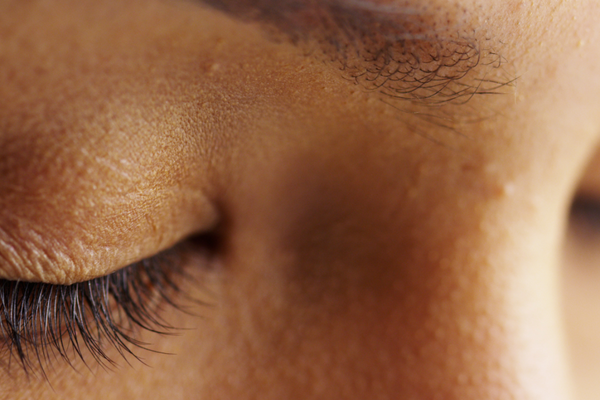How Your Mental Health Impacts Your Skin Health