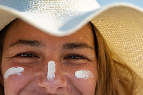Does Sunscreen Cause Breakouts?