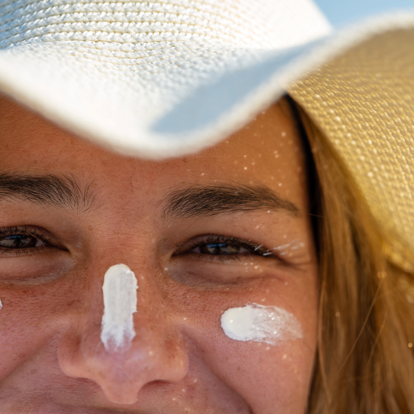 Does Sunscreen Cause Breakouts?