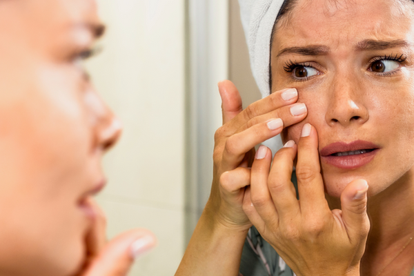 Scary Stuff on Your Skin and How to Keep it in Balance